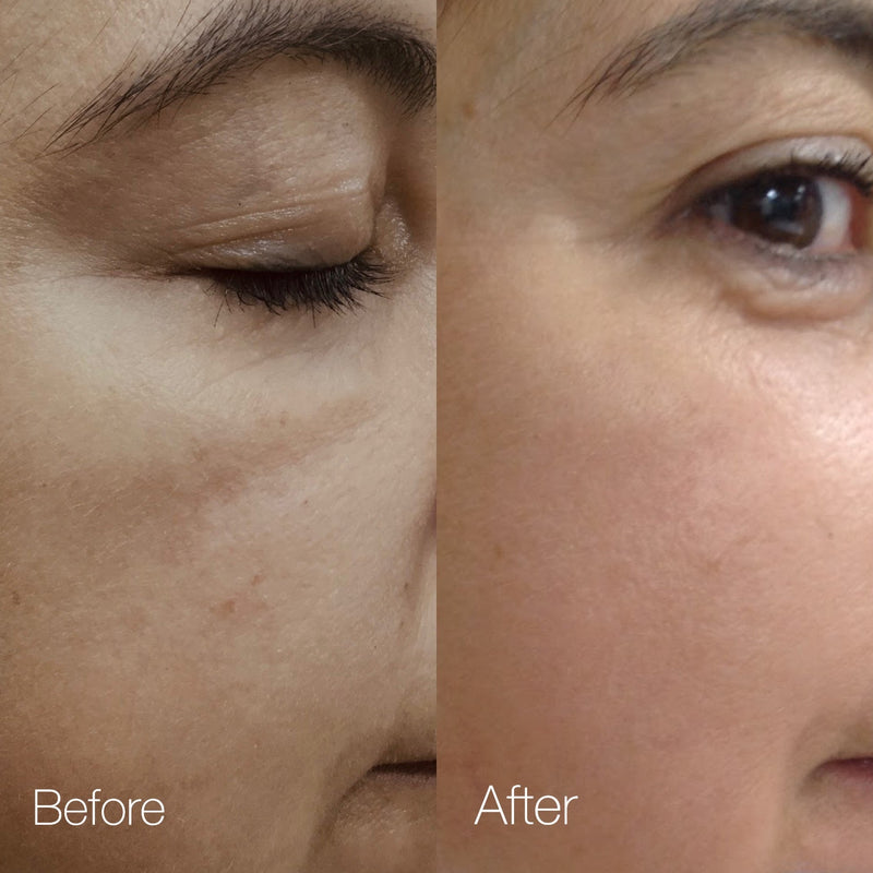 Pure Revival Peel