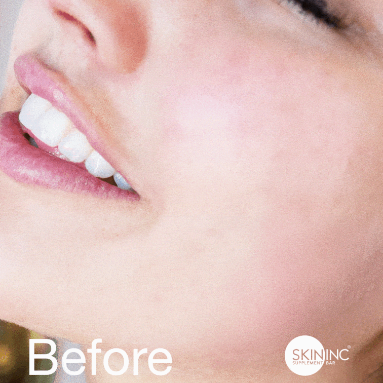 Skin inc glow filter serum before and after